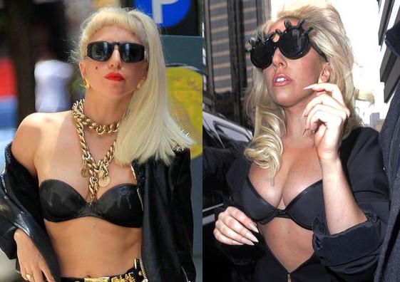 Lady Gaga Breast Implant