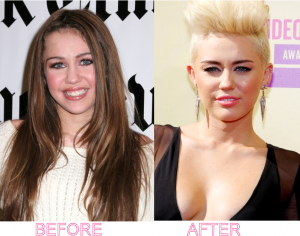 Miley Cyrus Breast Implant
