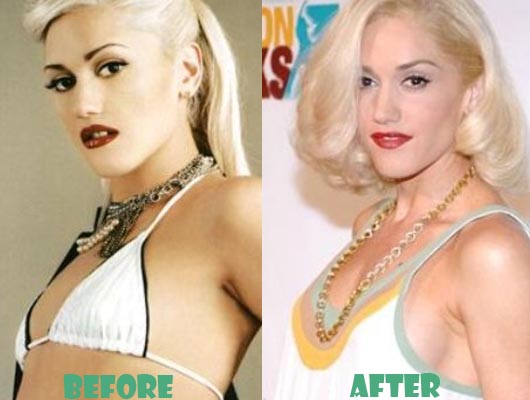 Gwen Stefani Boob Job - Bra Size Measurements.