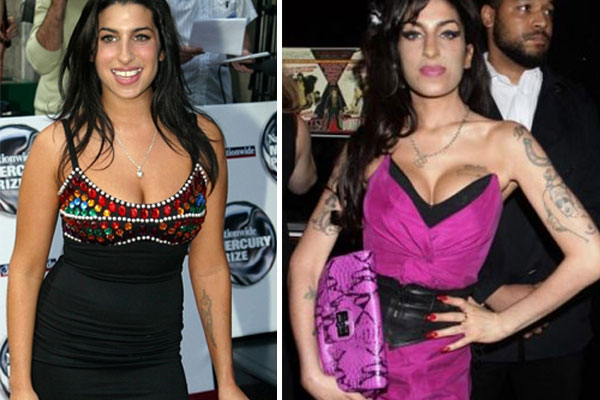 Amy Winehouse Boob Job Surgery